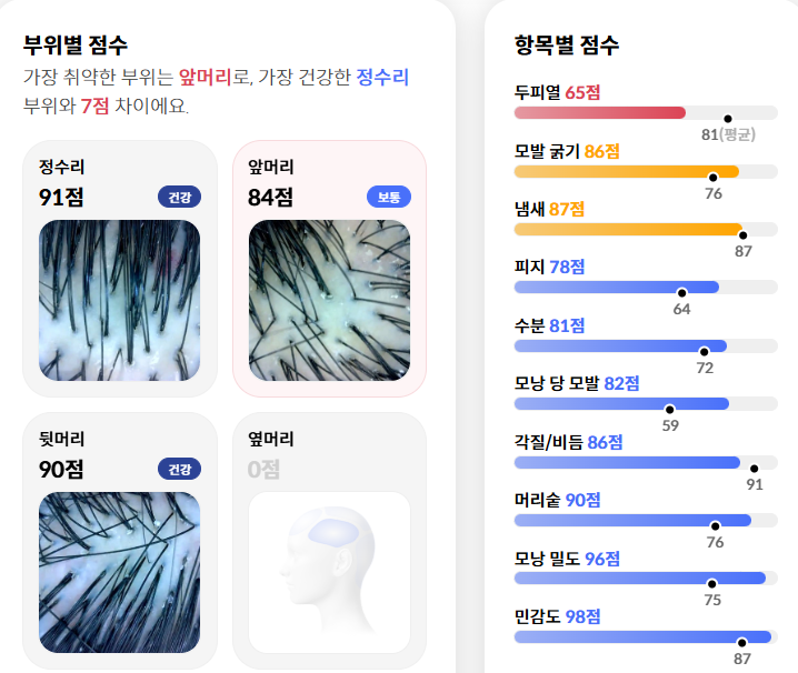 AI 두피 진단 결과 리포트 — 부위별·항목별 점수